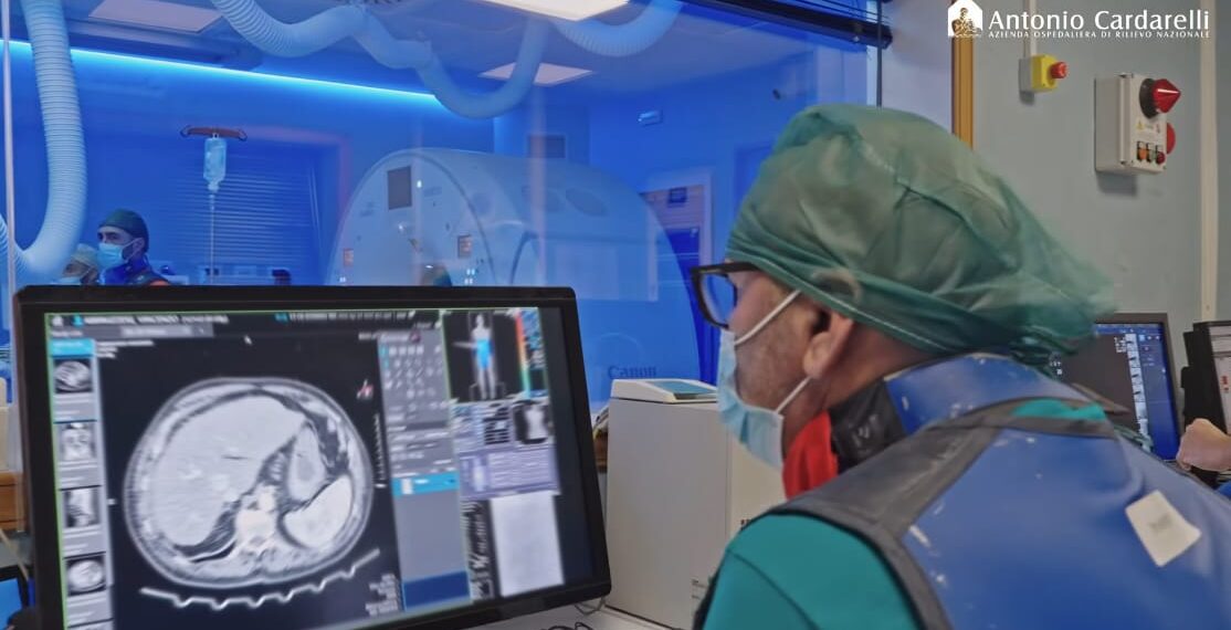 Tecniche di embolizzazione in urgenza, Cardarelli di Napoli per due giorni capitale mondiale della radiologia interventistica: al Centro di Biotecnologie specialisti dall’Arabia Saudita, Turchia, Marocco, Slovenia e Polonia