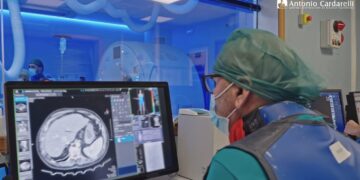 Tecniche di embolizzazione in urgenza, Cardarelli di Napoli per due giorni capitale mondiale della radiologia interventistica: al Centro di Biotecnologie specialisti dall’Arabia Saudita, Turchia, Marocco, Slovenia e Polonia