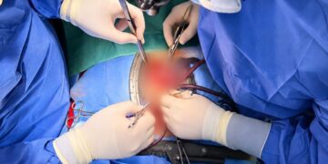 CHIRURGIA DEL RUGGI DI SALERNO IN DIRETTA MONDIALE: LIVE SURGERY DA MERCATO SAN SEVERINO IN COLLEGAMENTO CON L’IRCAD DI STRASBURGO.
