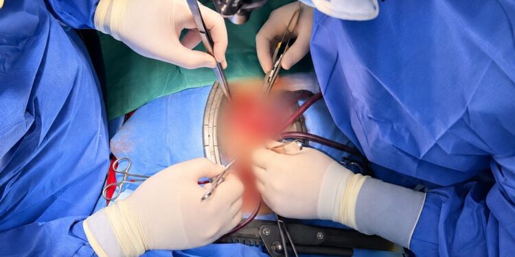 CHIRURGIA DEL RUGGI DI SALERNO IN DIRETTA MONDIALE: LIVE SURGERY DA MERCATO SAN SEVERINO IN COLLEGAMENTO CON L’IRCAD DI STRASBURGO.