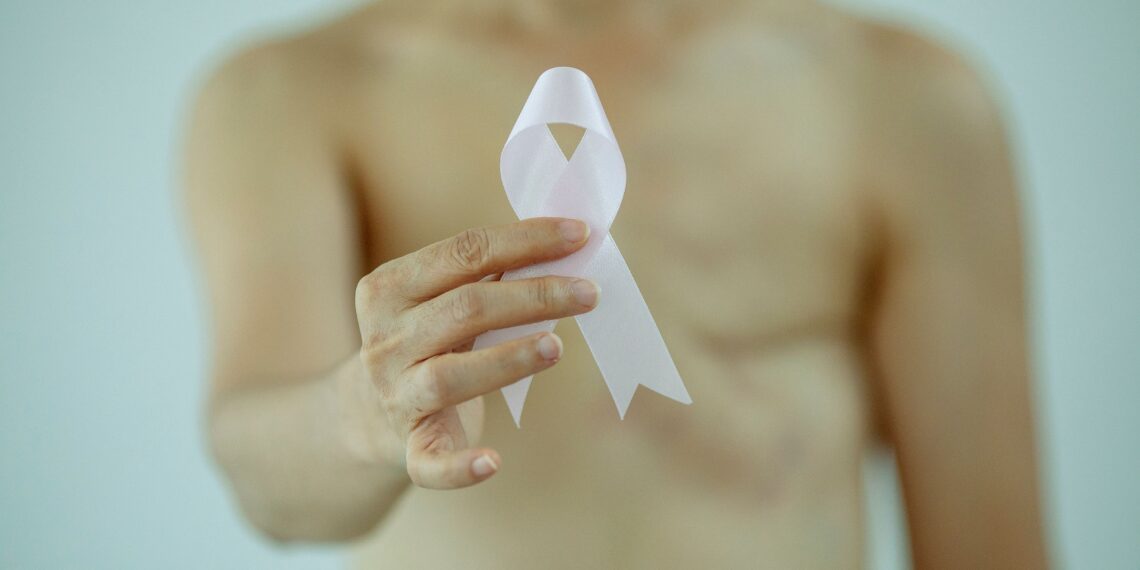 Radioterapia del tumore della prostata: il San Gerardo primo al mondo nella ricerca sull’ipofrazionamento