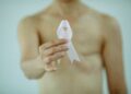Radioterapia del tumore della prostata: il San Gerardo primo al mondo nella ricerca sull’ipofrazionamento