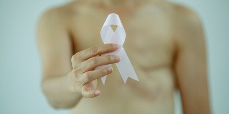 Radioterapia del tumore della prostata: il San Gerardo primo al mondo nella ricerca sull’ipofrazionamento